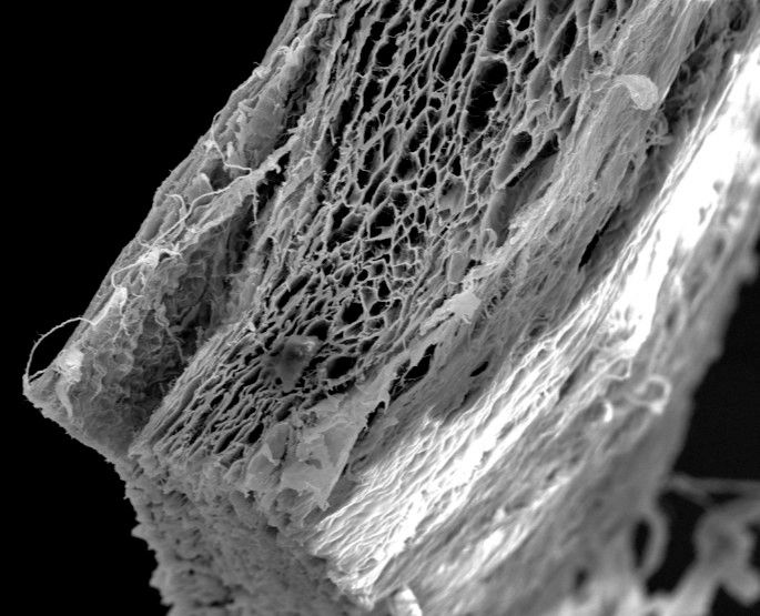Abb. 2: Die Jason® membrane weist eine natürlich poröse, mehrlagige Struktur auf, die eine hohe Biokompatibilität gewährleistet.