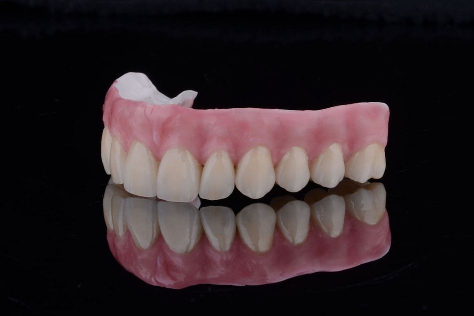 Figure 33. Final characterization with pink veneering composite. 