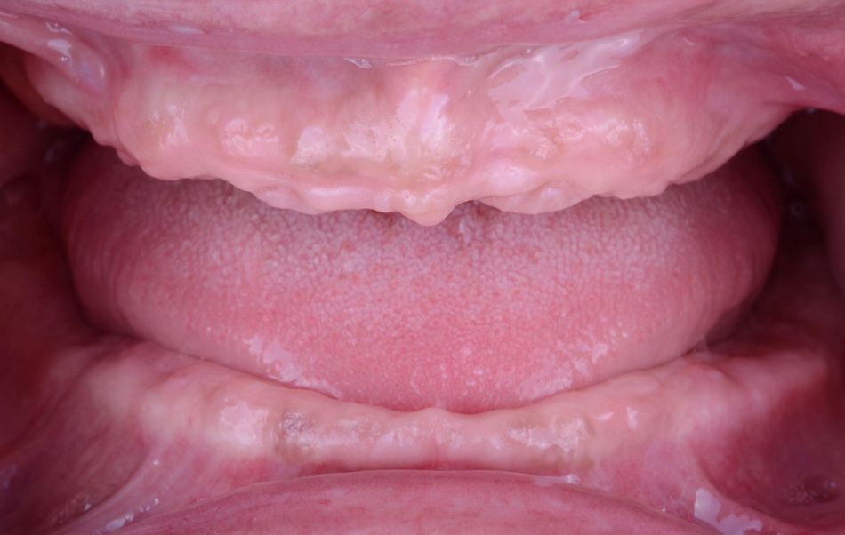 Figure 4. Baseline situation. Intraoral view. 