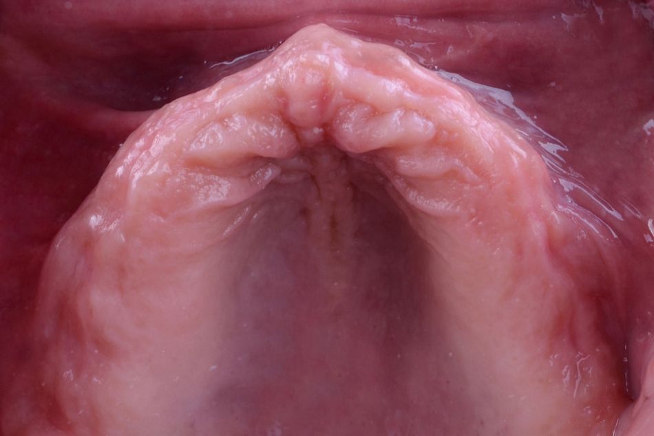 Figure 5. Baseline situation. Intraoral view. 