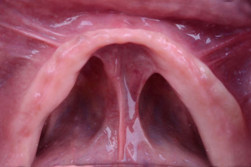 Figure 6. Baseline situation. Intraoral view. 
