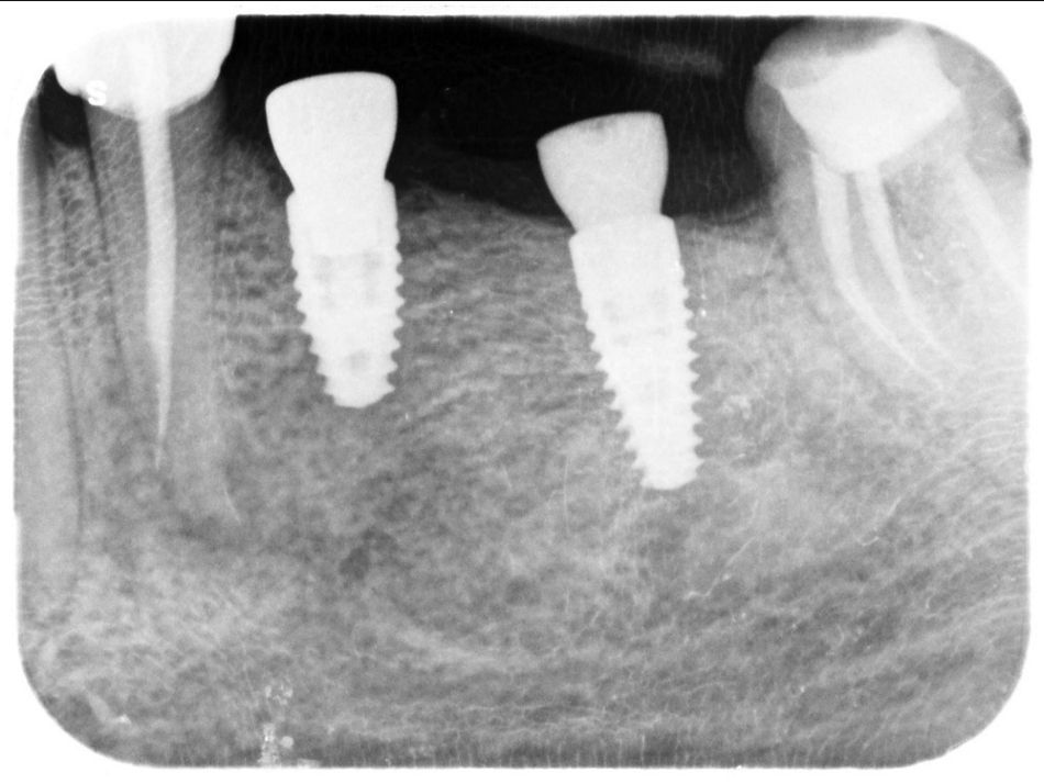 Fig. 14