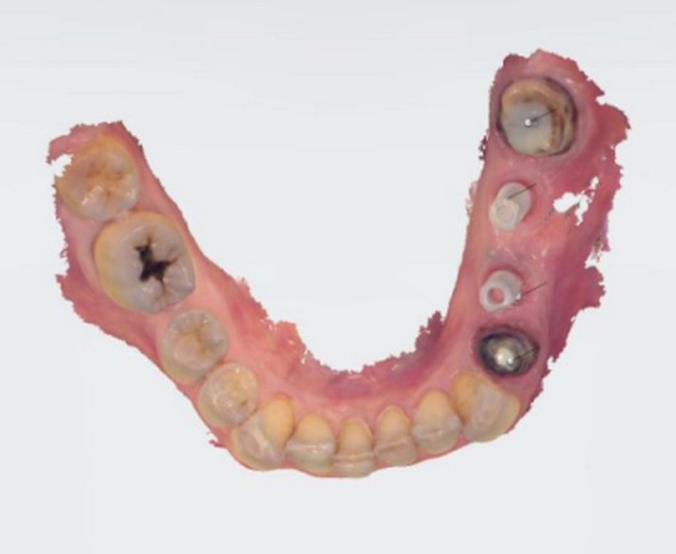 Fig. 17