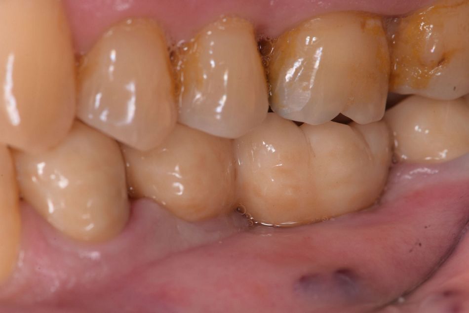 Fig. 24