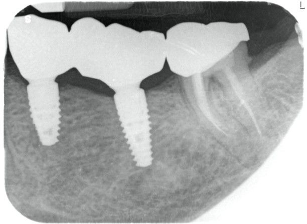 Fig. 25