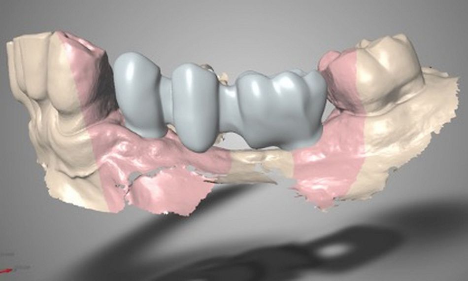 Fig. 28
