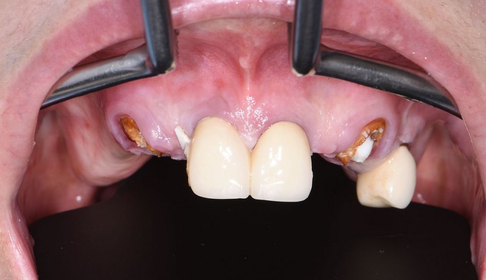 fig. 9