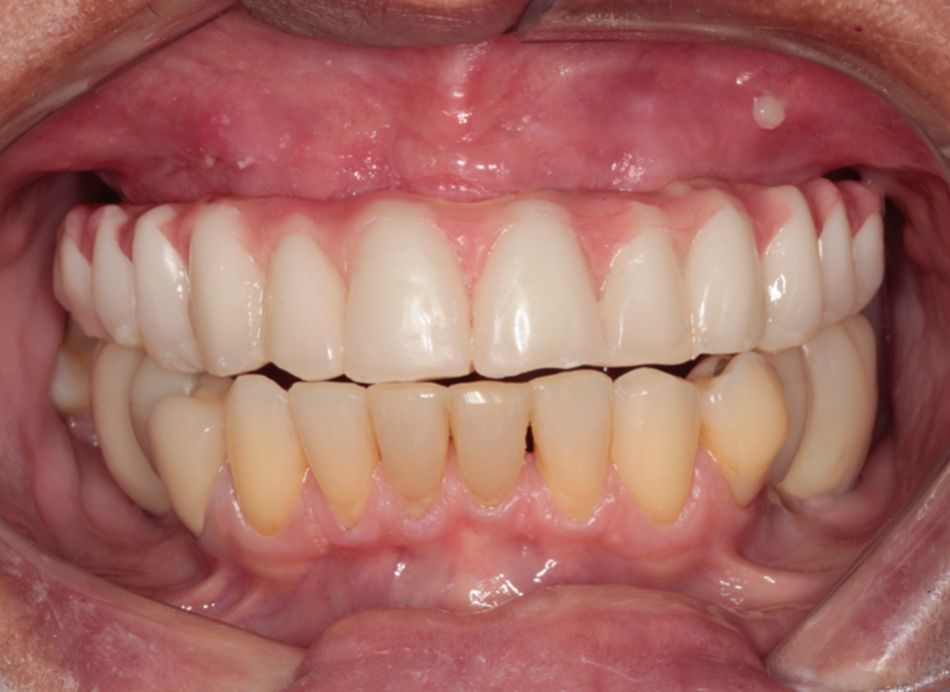 Fig 15