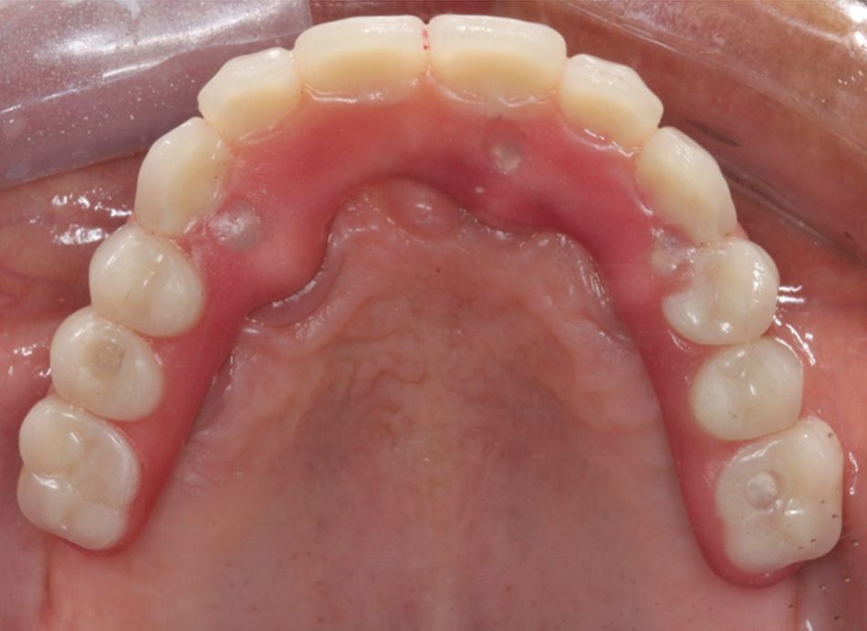 Fig 23