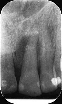 Fig. 1: Before surgery