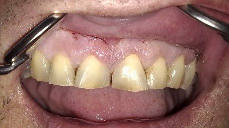 Fig. 2 Pre-op situation