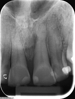 Fig. 7: 12 months post-op