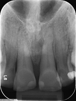 Fig. 9: 36 months post-op