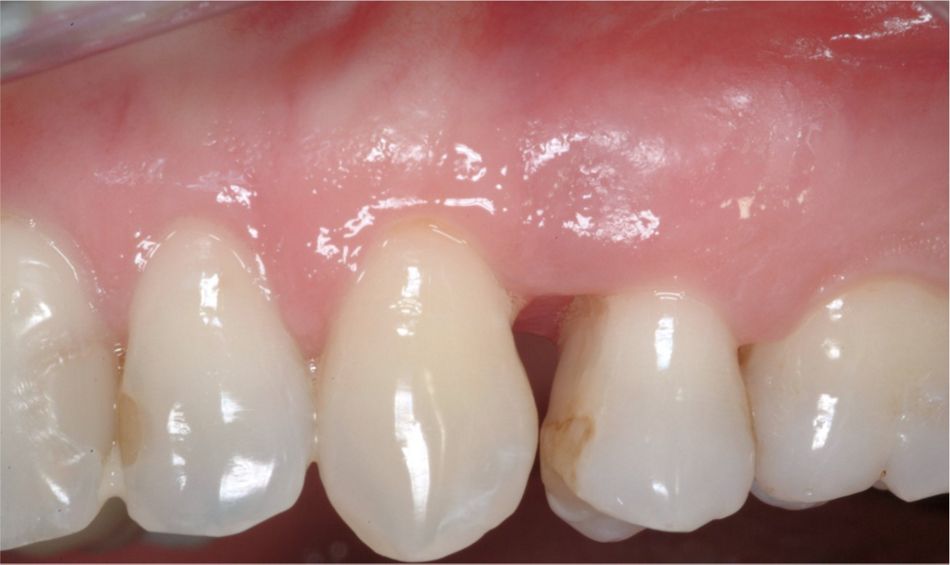 Fig. 1: Initial clinical situation