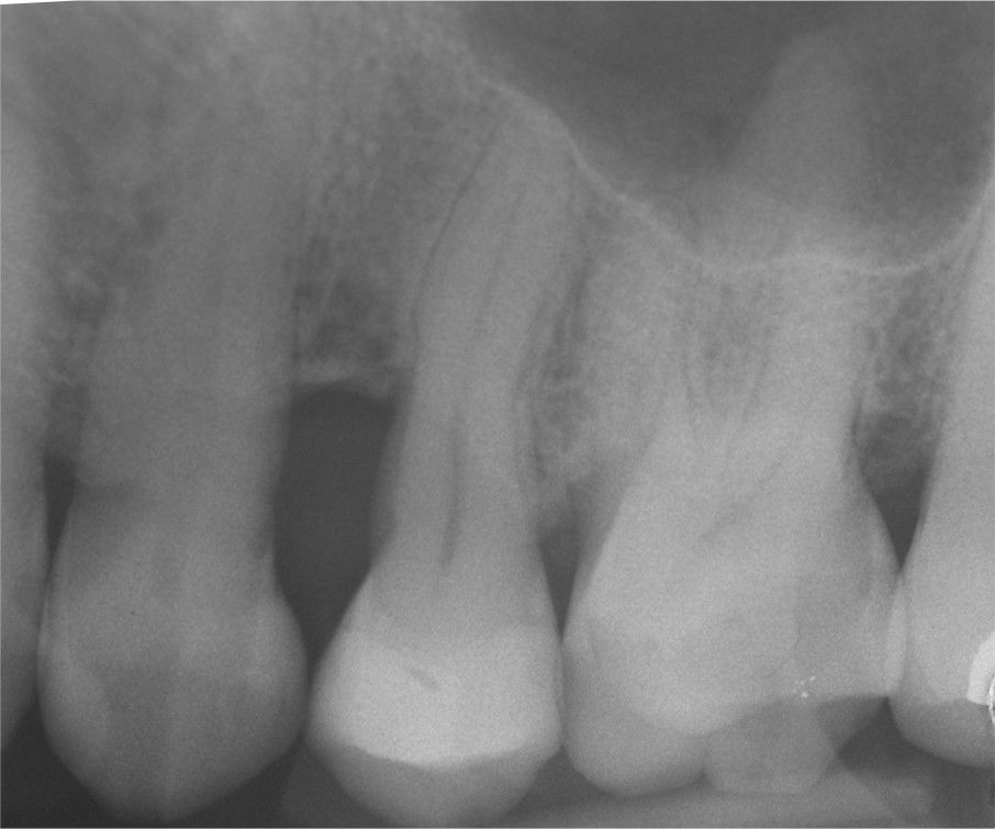 Fig. 8: 5 years follow-up