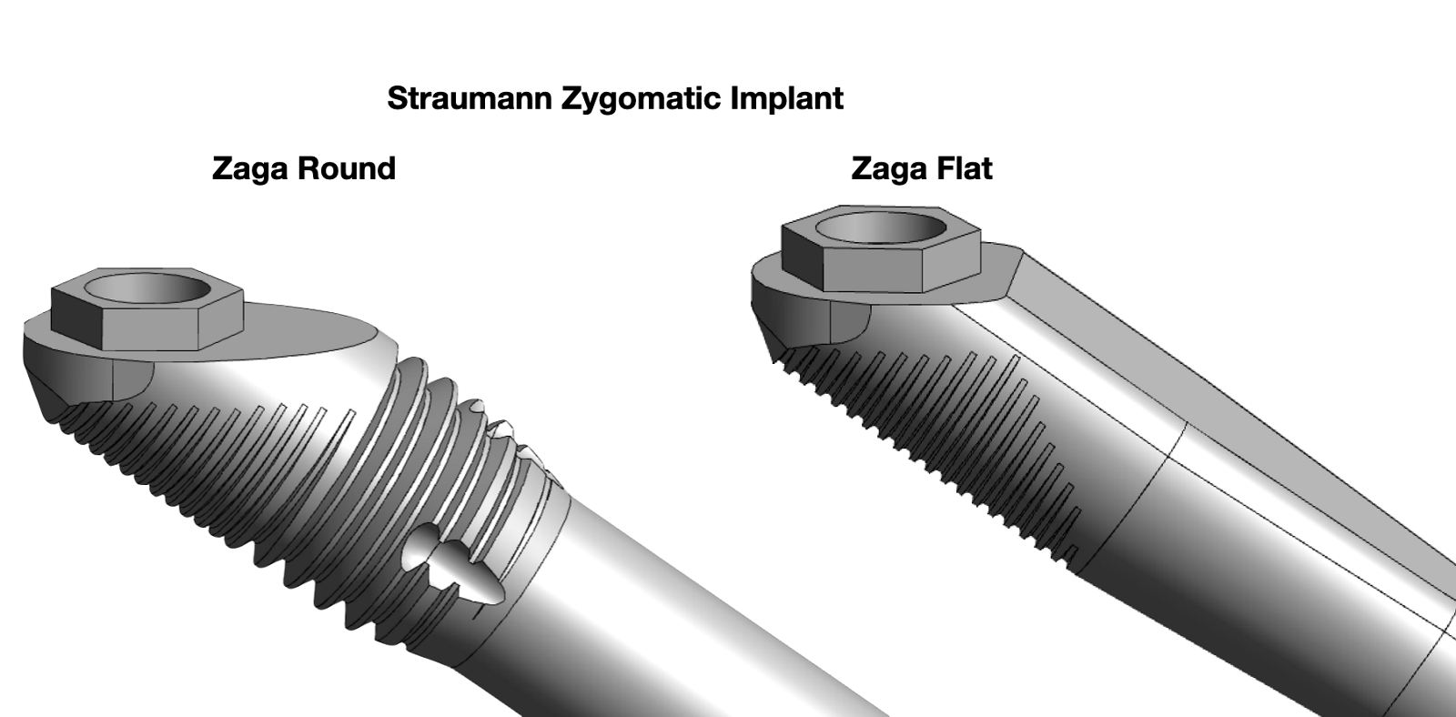 Is Zygomatic Implant Slot Technique a Russian Roulette?