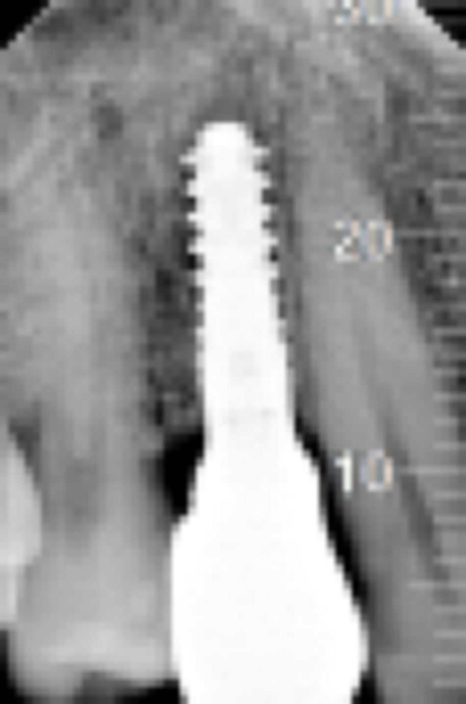 Fig.20