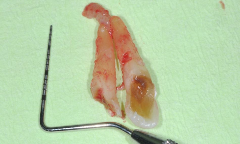 Fig.4
