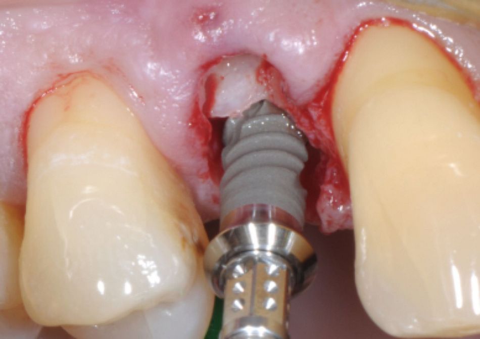 Fig.7