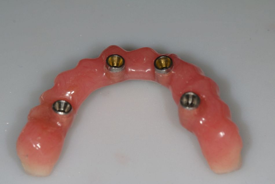 Fig 15: Notice the convex shape of the bridge.