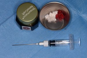Management of peri-implant bone defects – a combined