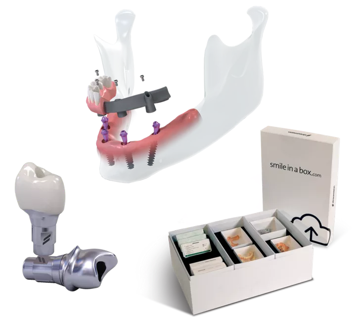 Immediate fixed full arch treatments