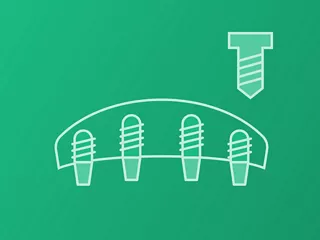 Single-tooth (Cement retained)