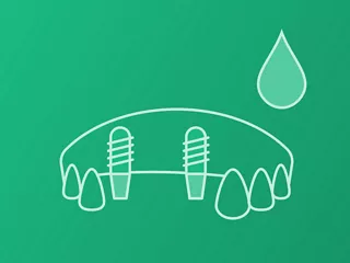 Single-tooth (Screw retained)