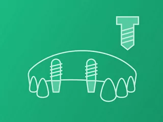 Multi-units (Screw retained)