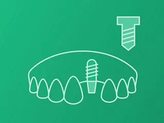 Single-tooth (Screw retained)