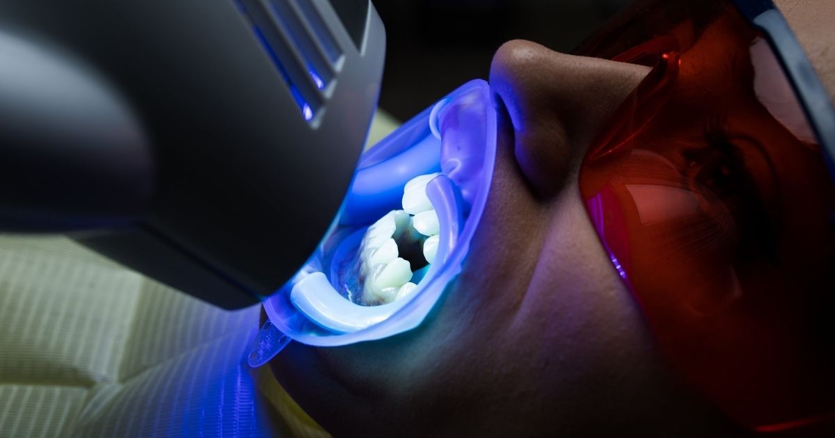 A man trying to whiten dental implants and teeth
