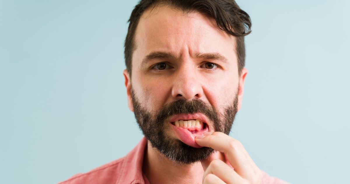 A man with painful gums due to the periodontal disease