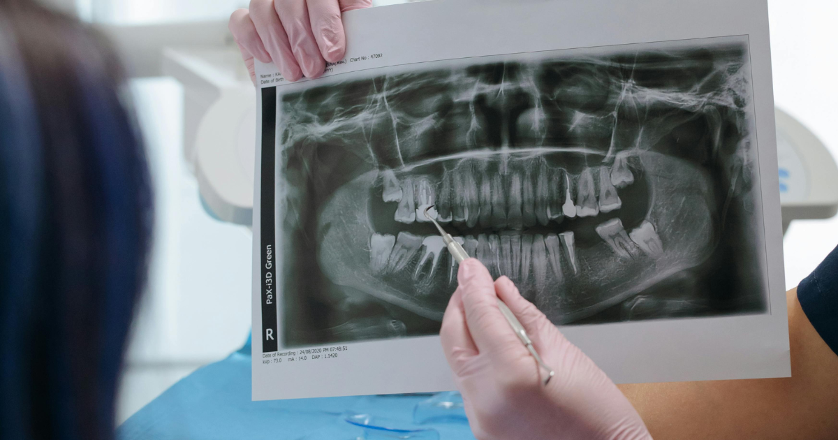 dental check up scans to evaluate oral health